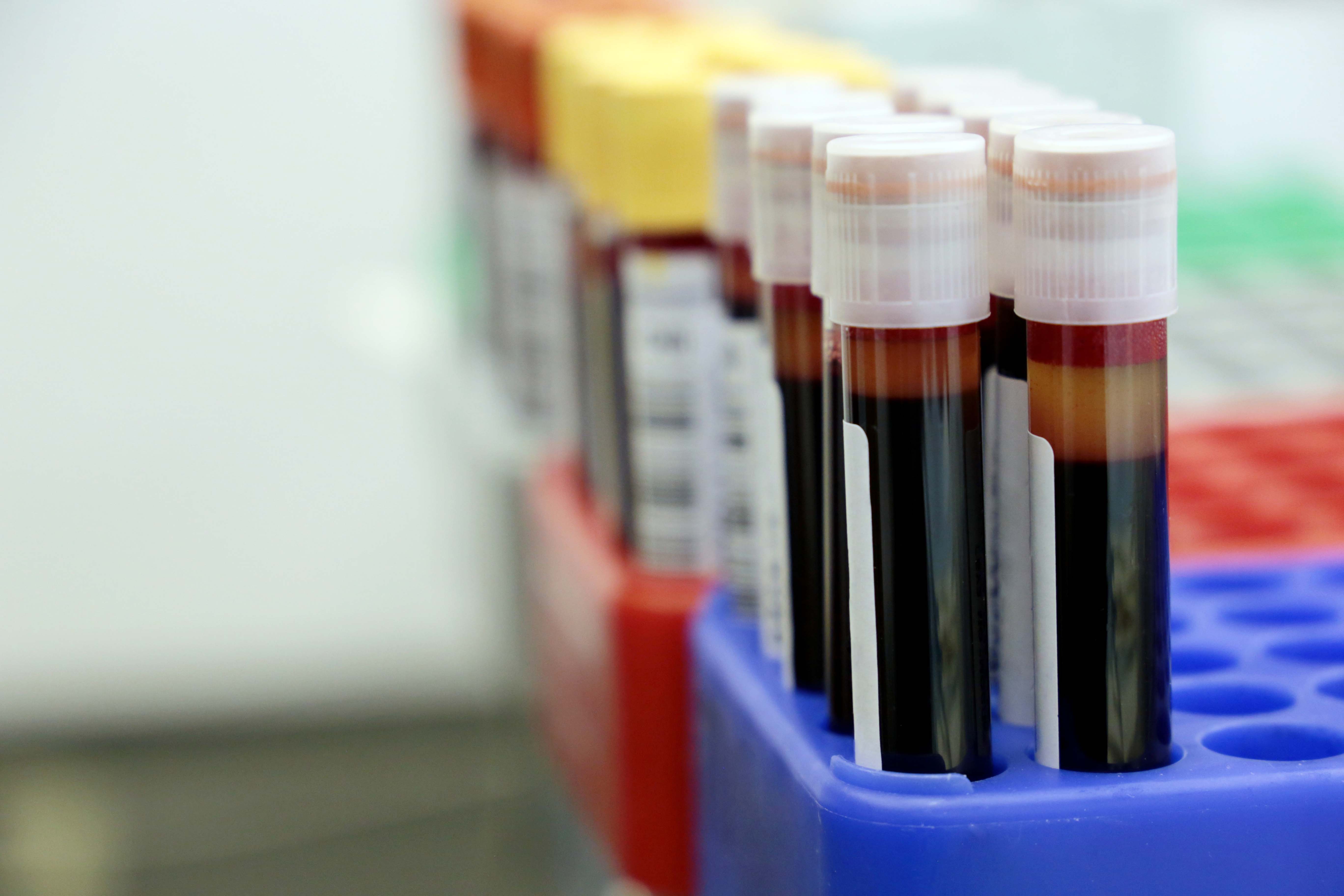 Vials of blood in the medical laboratory