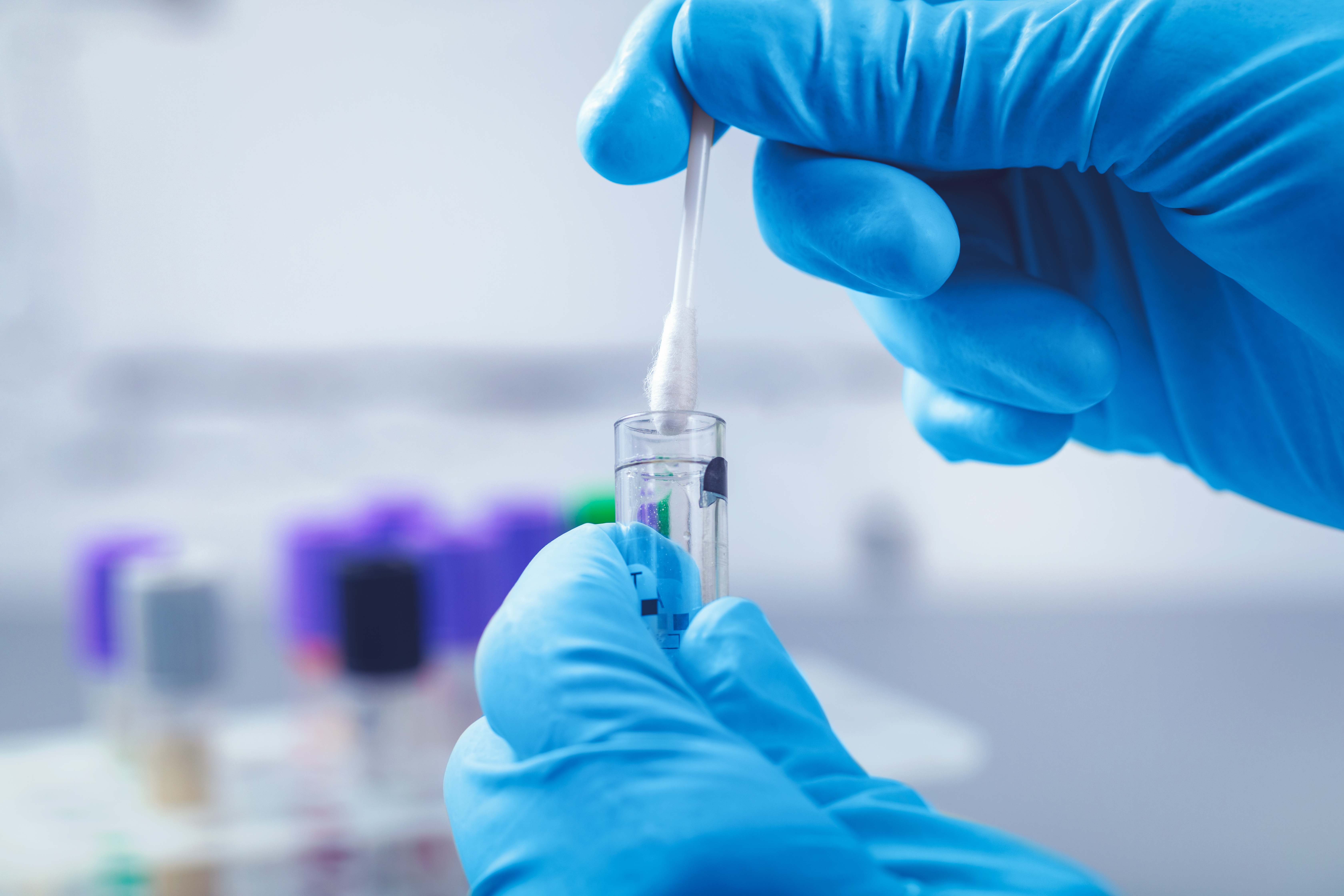 scientist in lab collect dna sample in test tube with swab