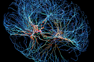 Neuron system