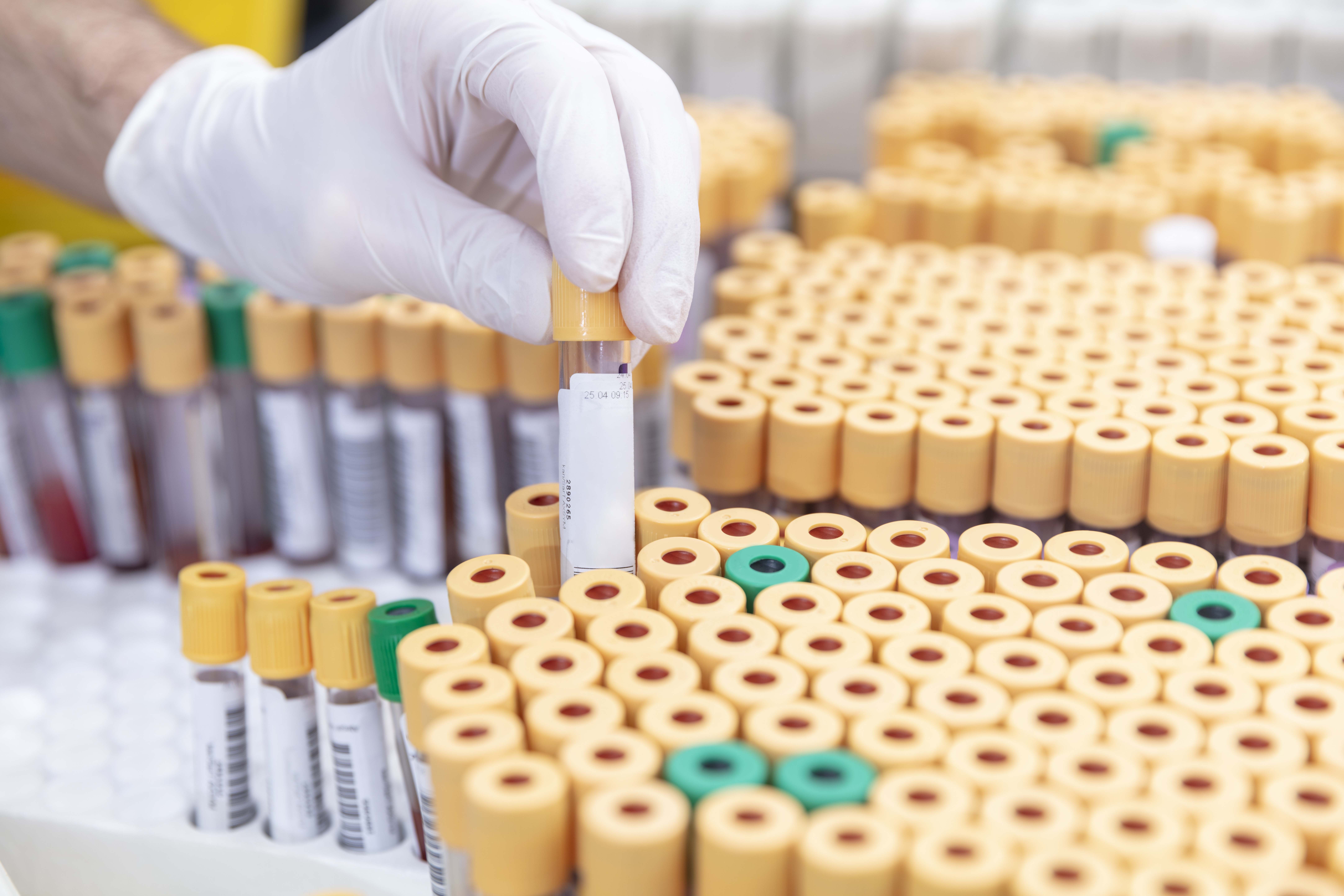 Scientist handling test tubes in laboratory
