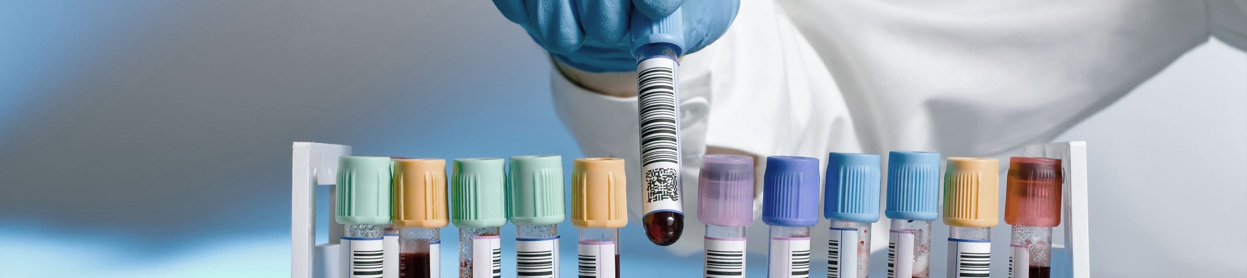 Three ways Horizon improves public health efforts - Clinisys
